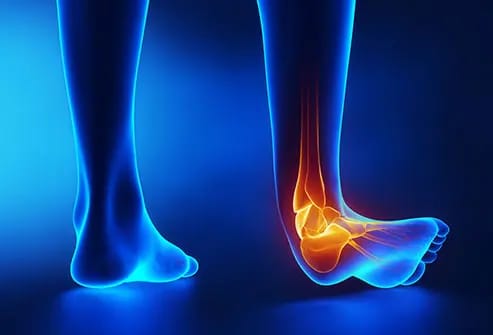 Ankle and foot pain physiotherapy treatment at Munir Hafeez Medical Center Gujranwala